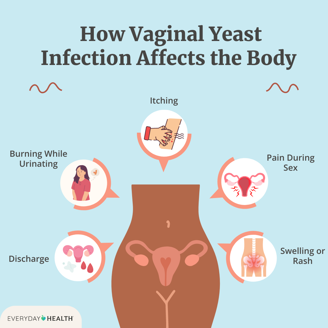 eh-how-vaginal-yeast-infection-affects-the-body-seo-graphic_lauren.png