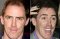 rob-brydon-hair-transplant.jpg